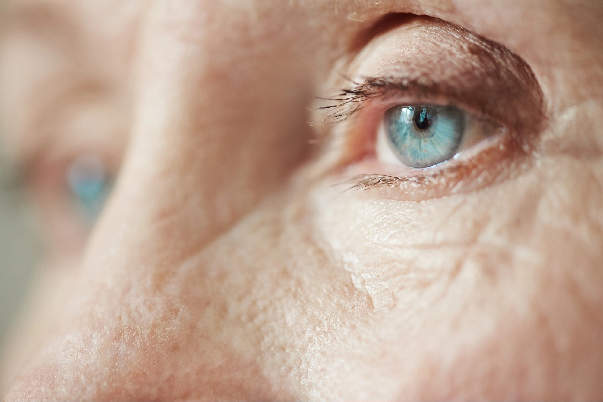 Close-up of a human eye preparing for cataract surgery